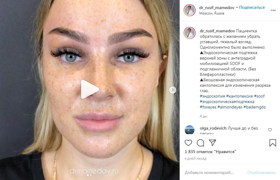 Пластический хирург использует в посте оптимальное число тегов — до десяти
